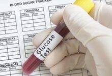 السكر في الدم.. أرقام وملاحظات